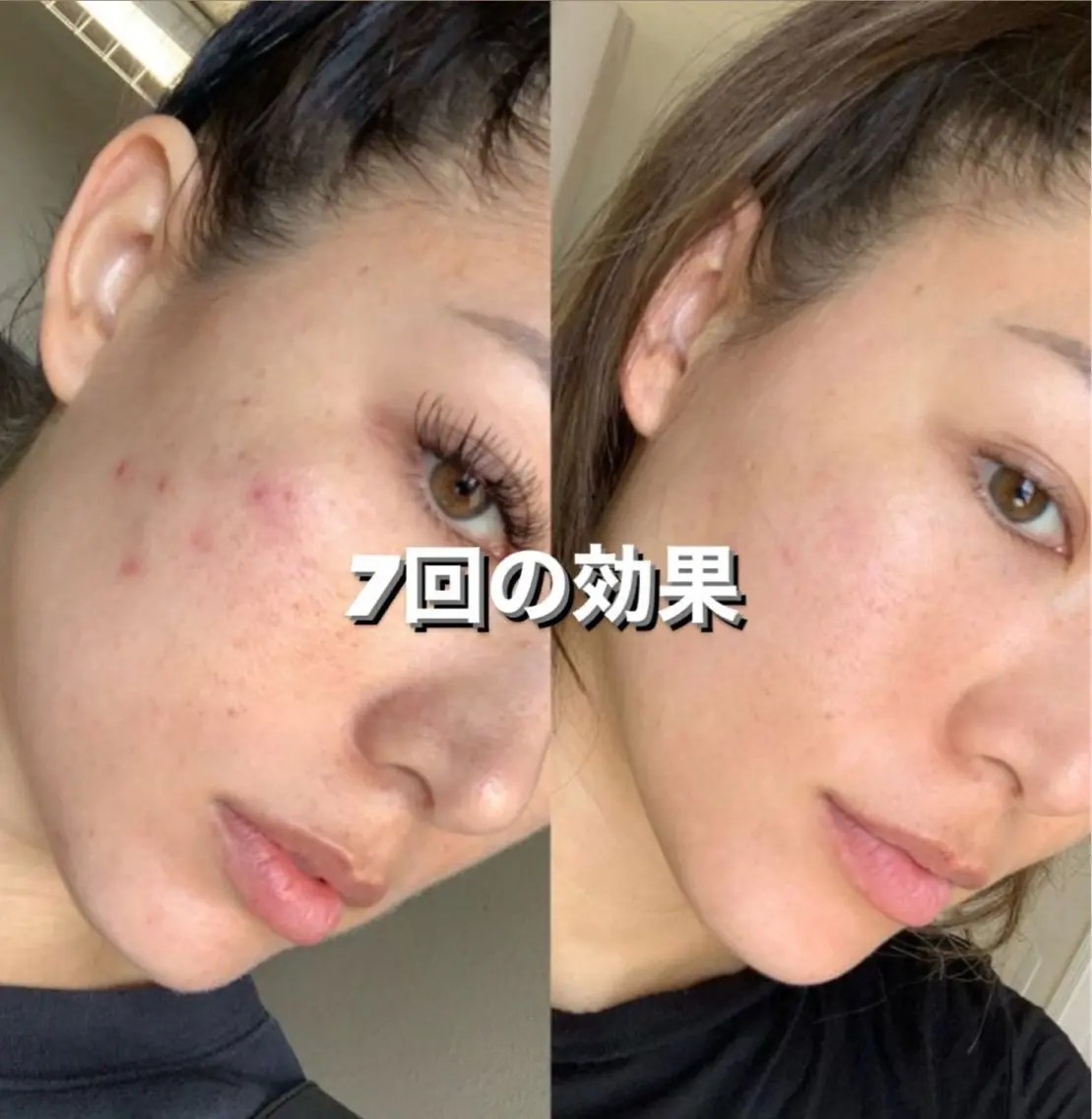 川﨑 杏莉のエステ・リラクイメージ
