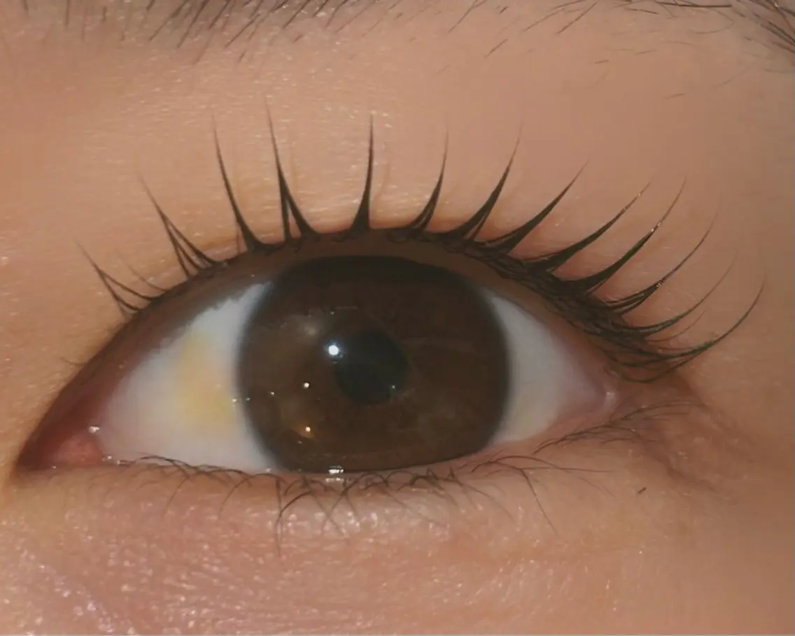 マツエク・マツパ 一重×まつ毛パーマ マツパ mai  CHION eyelashのマツエク・マツパデザイン