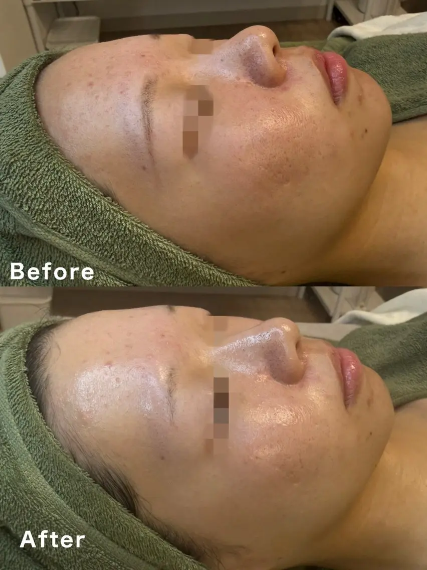 エステ Beautys alonLei藤沢店のエステ・リラクイメージ