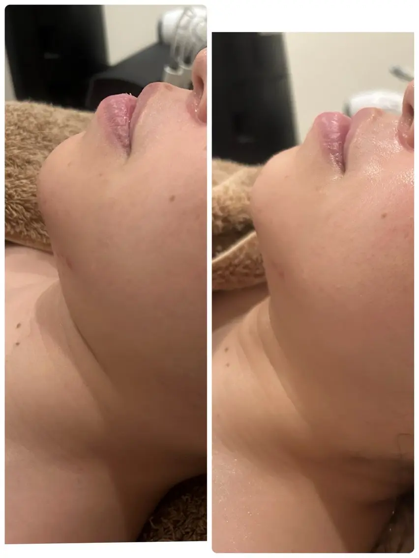 💆‍♀️お手軽人気コース☆デコルテ肩甲骨周り、リフトアップマッサージ付💆‍♀️『アドバンスコース+スペシャルケア』の写真