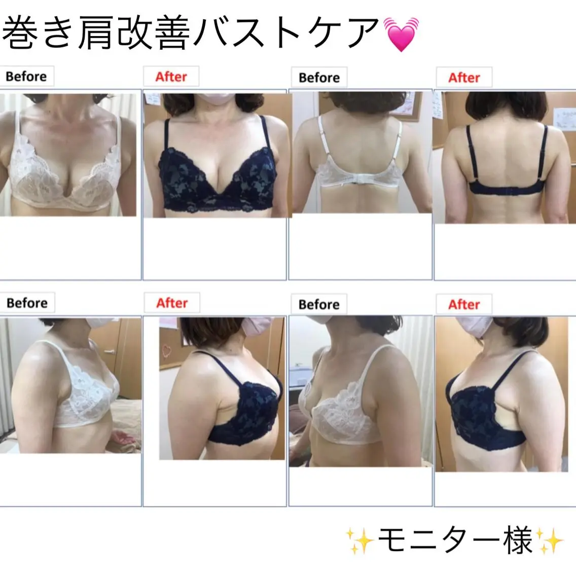 💖マシュマロバスト💖ハンド×光×EMS⚡バストケアしつつ姿勢もケアしたい方に!の写真
