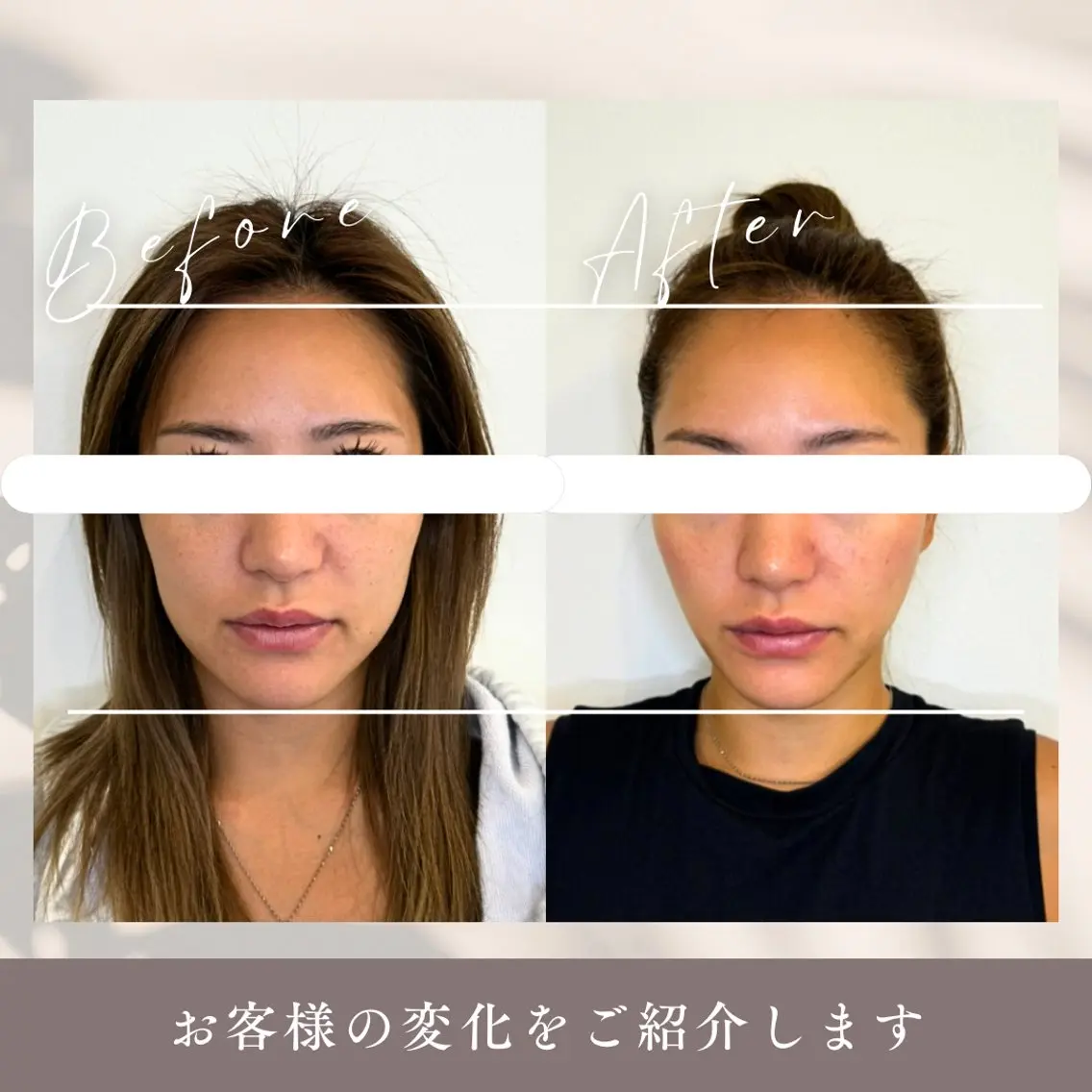 小顔矯正&美容整体 整え屋REDのエステ・リラクイメージ