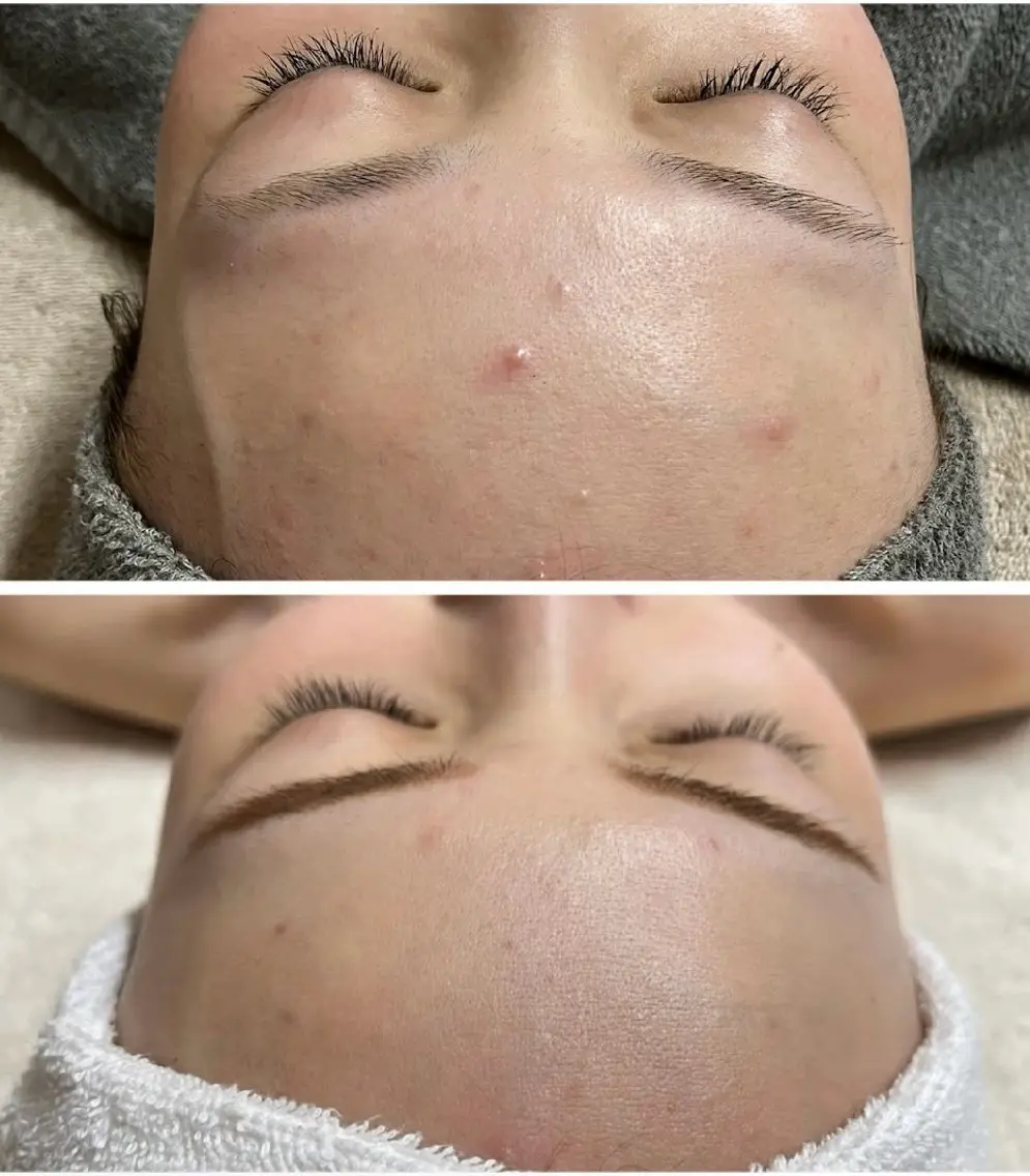 エステ esthesalon O'-en-のエステ・リラクイメージ