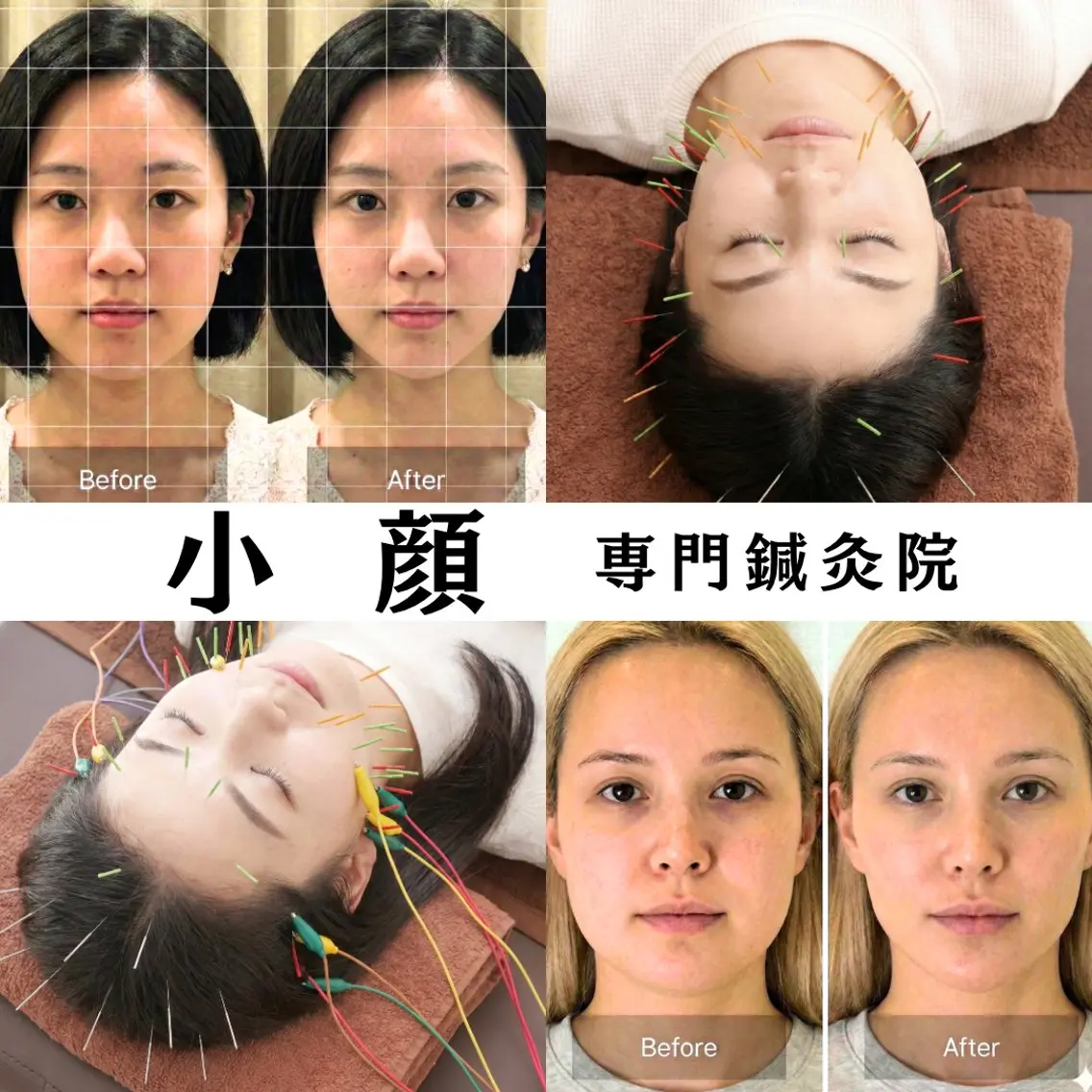 小顔・たるみ専門 DAZZLEのエステ・リラクイメージ
