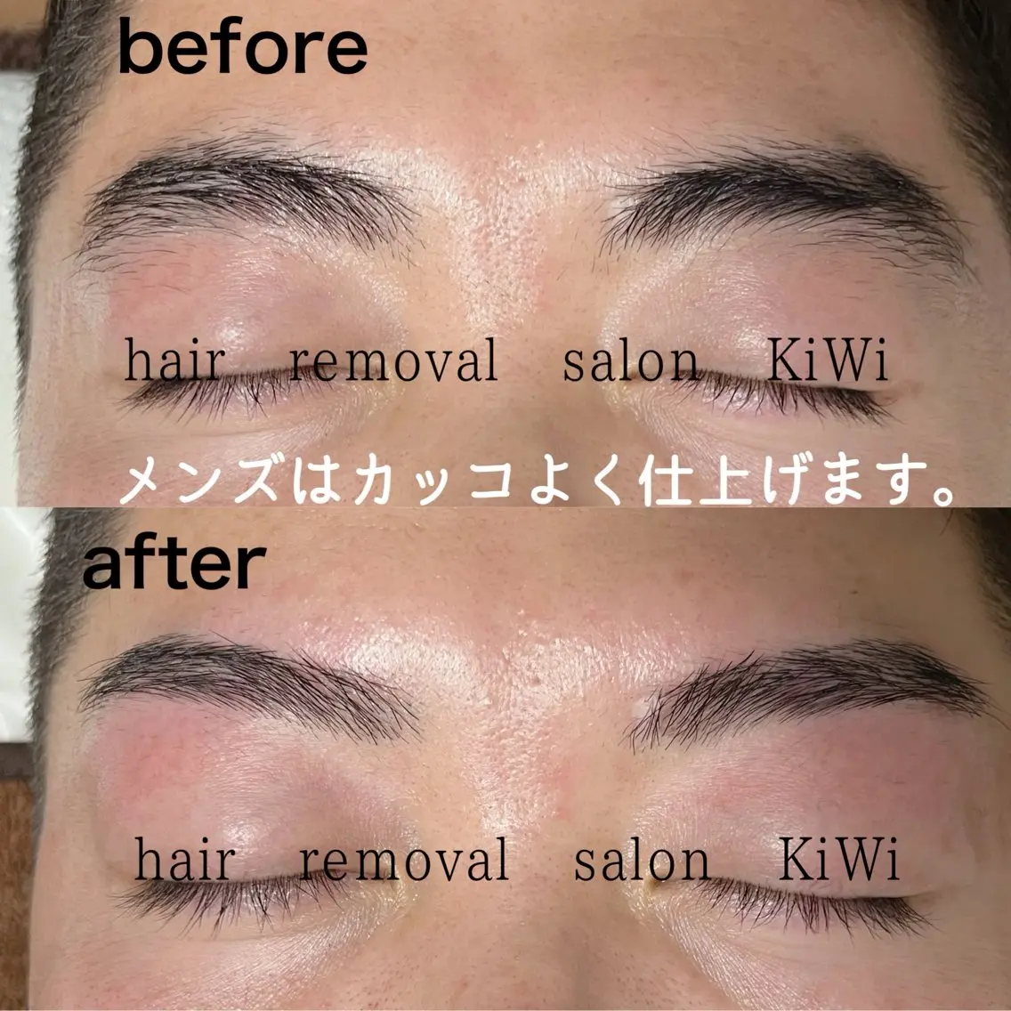 アイブロウ メンズアイブロウ 脱毛サロン KiWiのエステ・リラクイメージ