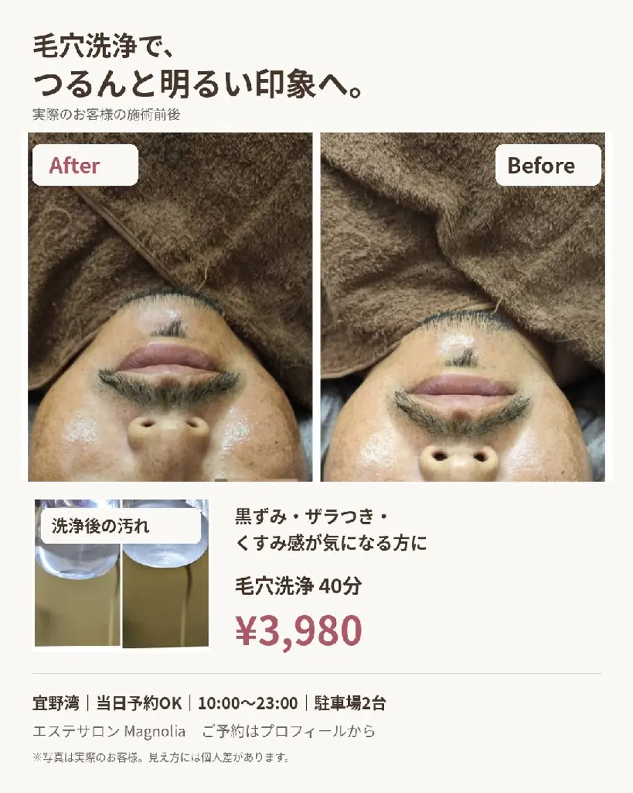 毛穴すっきりフェイシャルの写真