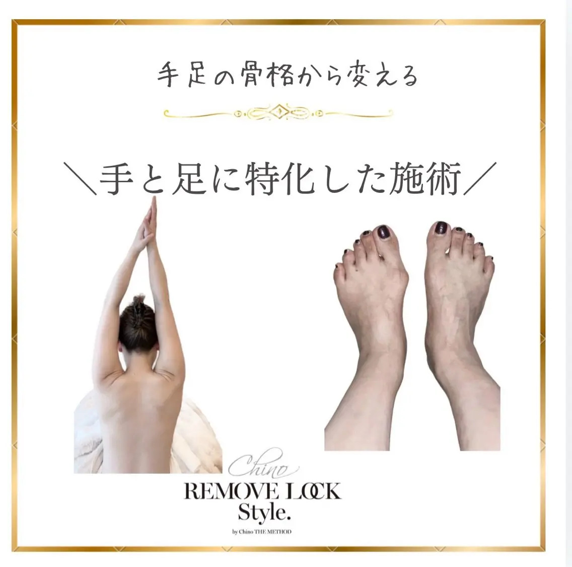 【手のアーチ形成】手・腕から骨格を変える★巻き肩・肩こり/首肩、腕が痛いという方必須の写真