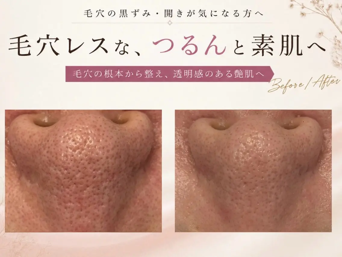 小顔/毛穴/ニキビ salon bealのエステ・リラクイメージ