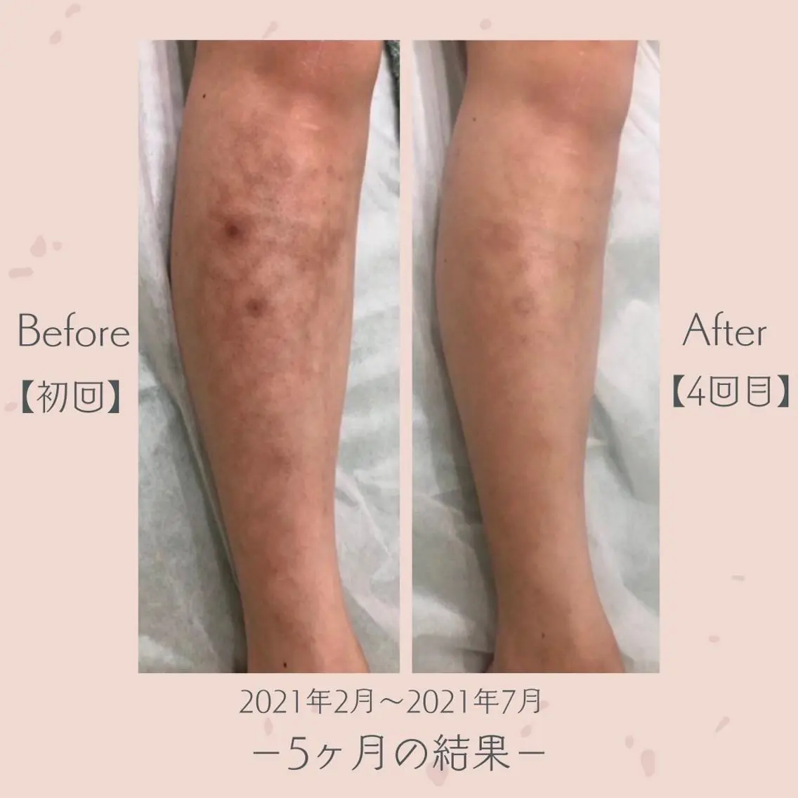 エステ＆美肌脱毛 ココサロ倉敷店のエステ・リラクイメージ