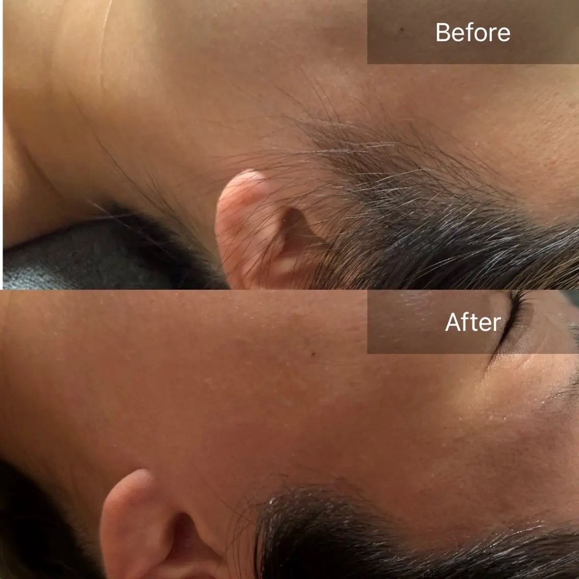 脱毛 enine フェイスWAXのエステ・リラクイメージ