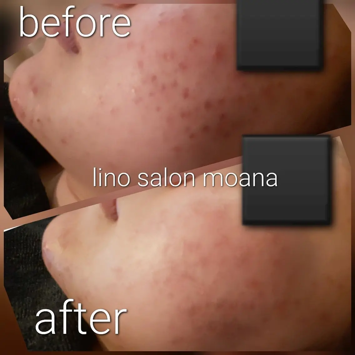 lino salon  moanaのエステ・リラクイメージ
