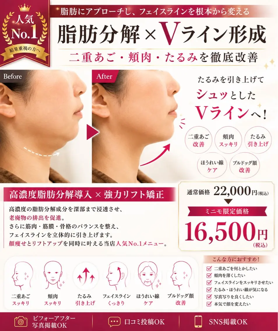 【人気No.1】顔脂肪×Vライン形成|二重あご・頬肉・たるみ改善60分の写真