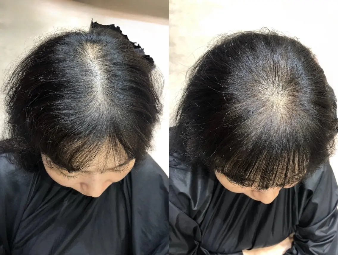 カット 生えぐせ改善 黒木のヘアスタイル