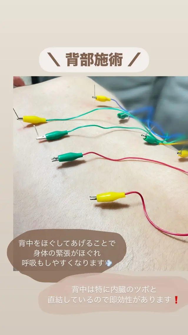 美容鍼/鍼灸 ここみ鍼灸院のエステ・リラクイメージ