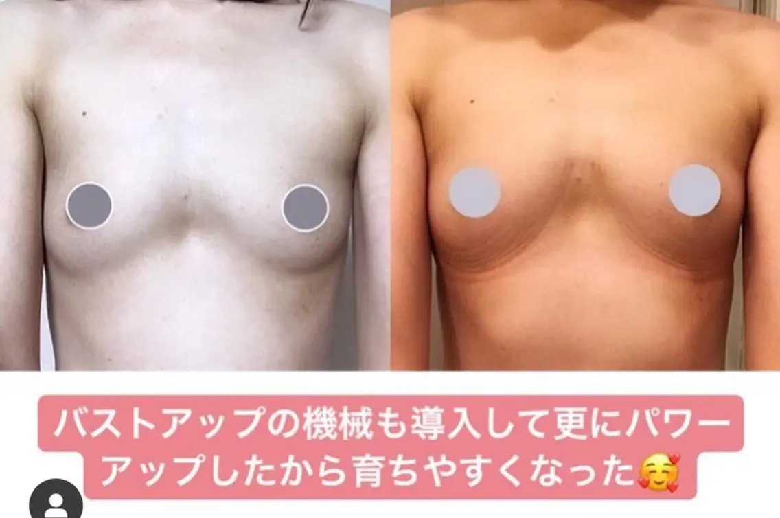 バストアップサロン エミルカのその他イメージ