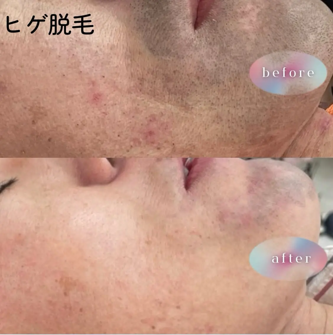 メンズ La・Luana Cocoroのエステ・リラクイメージ