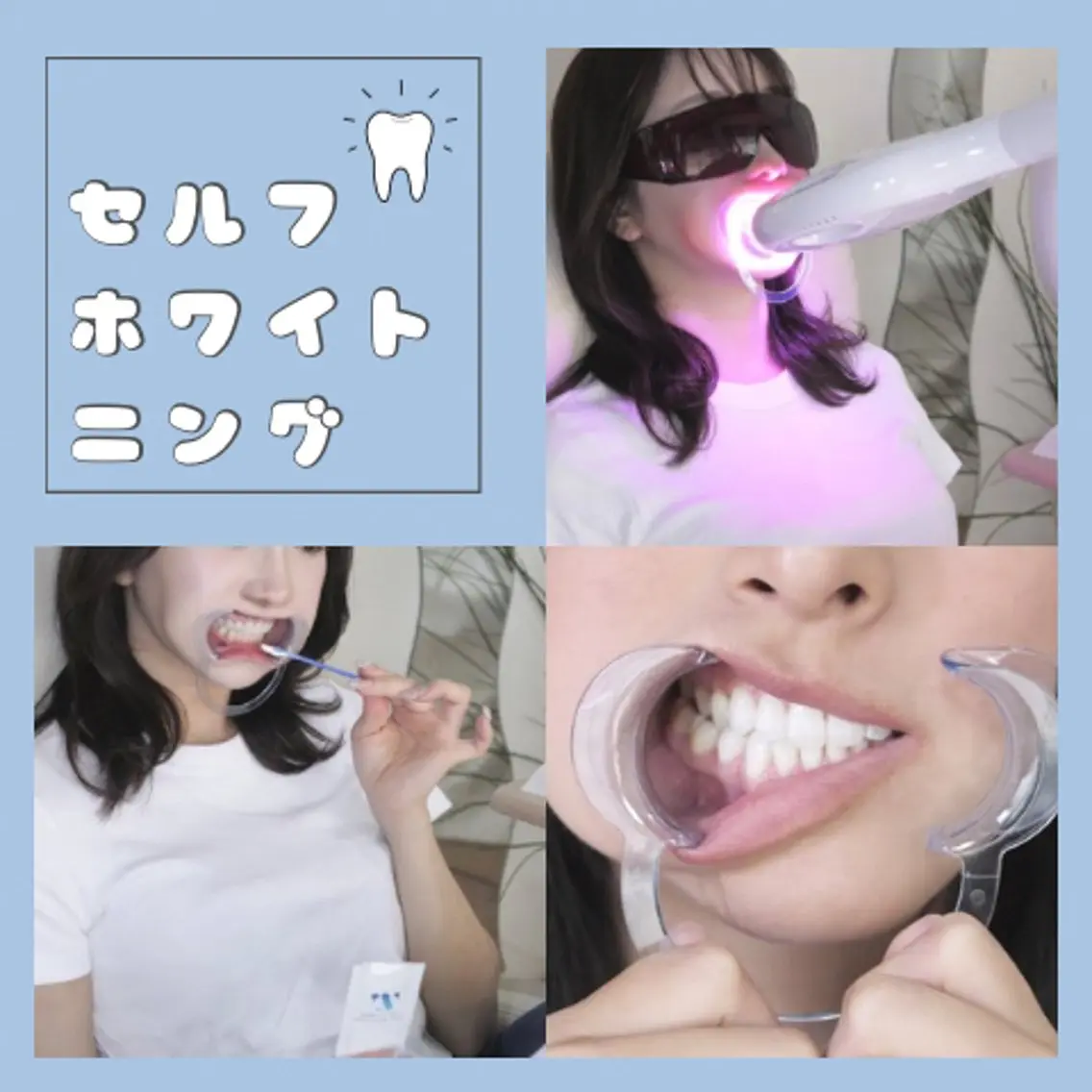 【歯の黄ばみに🦷✨】まずはお試し🙆『8分×2回』で透明感ある自然な歯に！人目を気にせず自分磨き✴︎ホワイトニングの写真