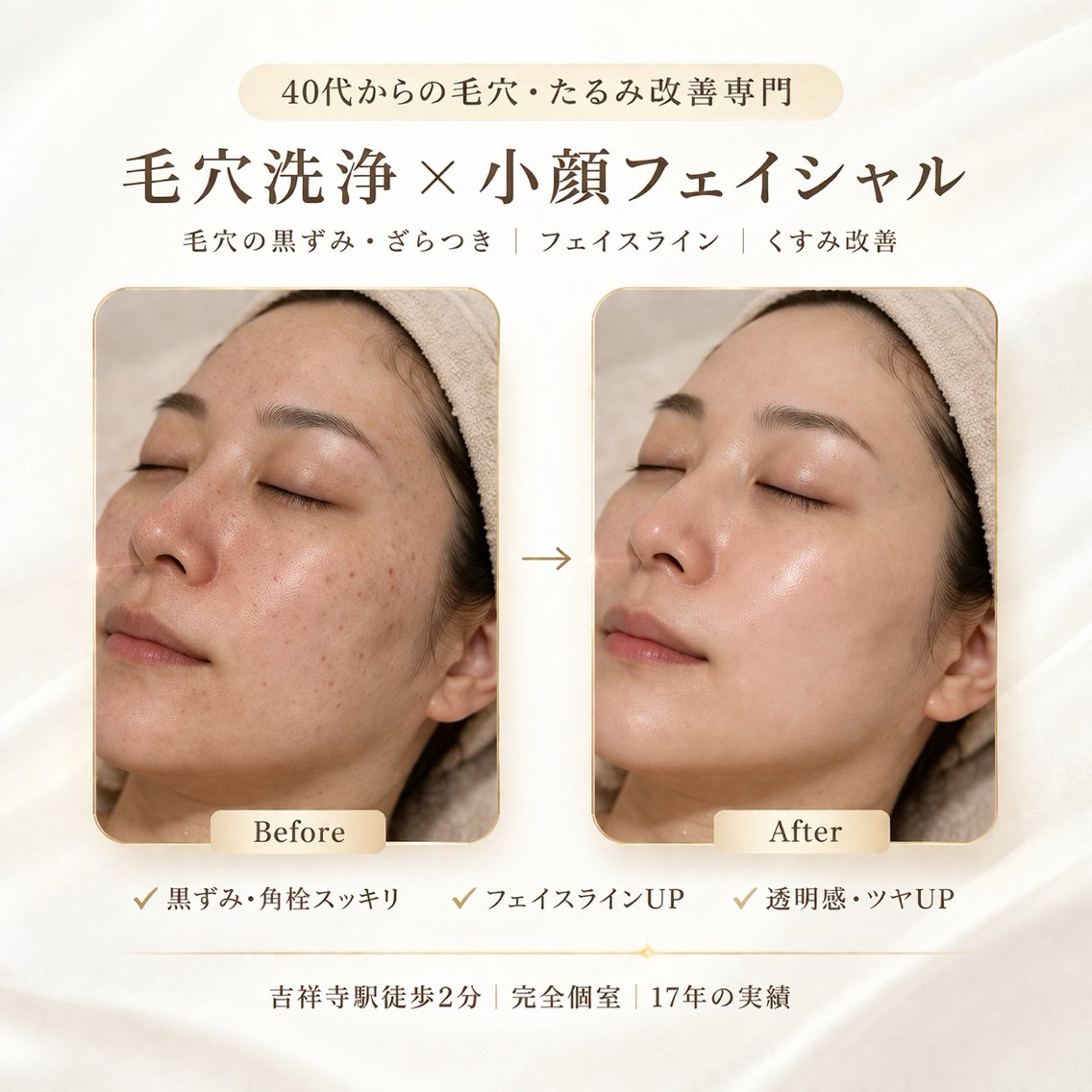 エステ 吉祥寺肌質改善専門店 A-beautyのエステ・リラクイメージ