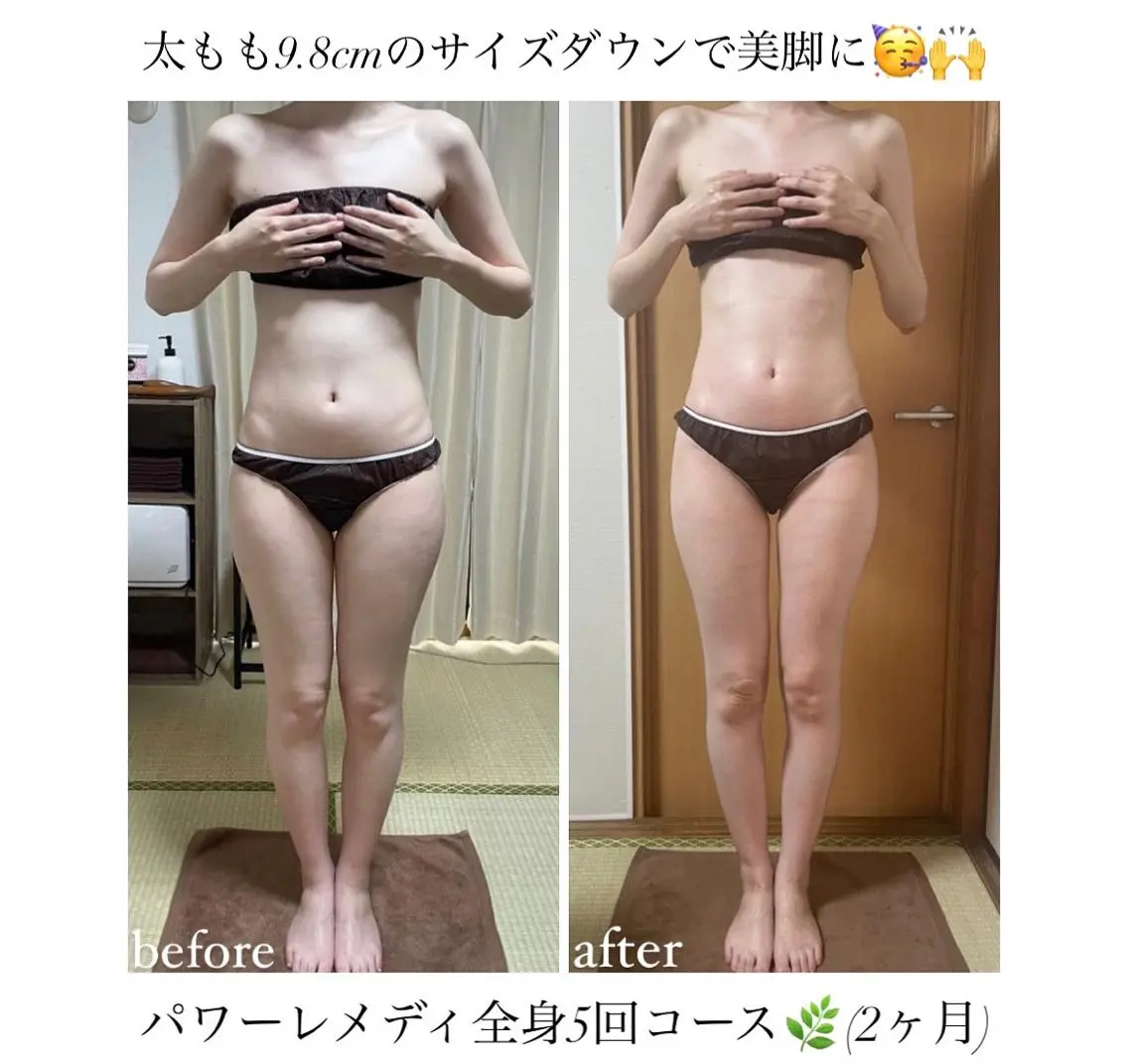 《本気痩せ×疲労改善 》 BILOOPのエステ・リラクイメージ