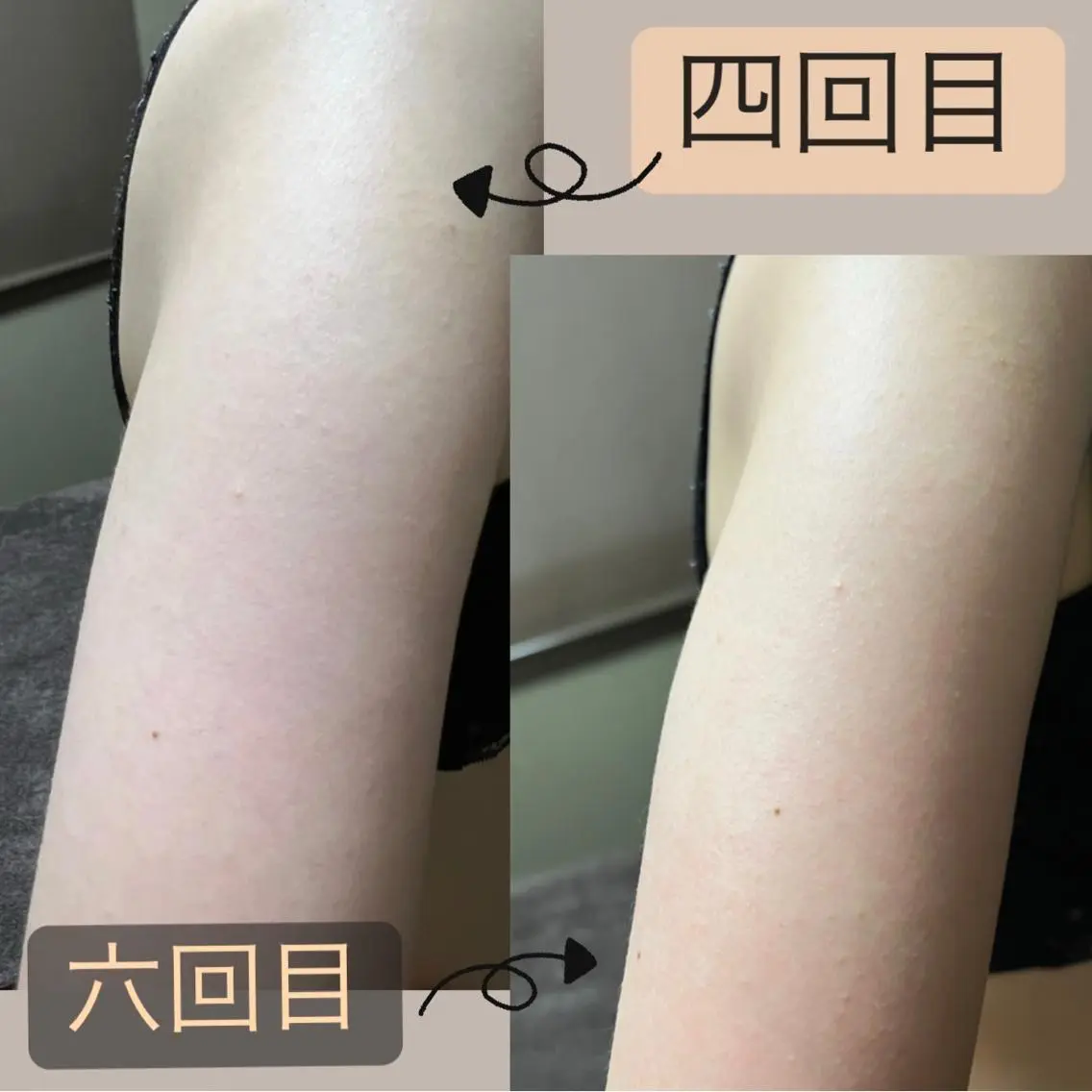 エステ リラク lymph care 'Welnəsのエステ・リラクイメージ