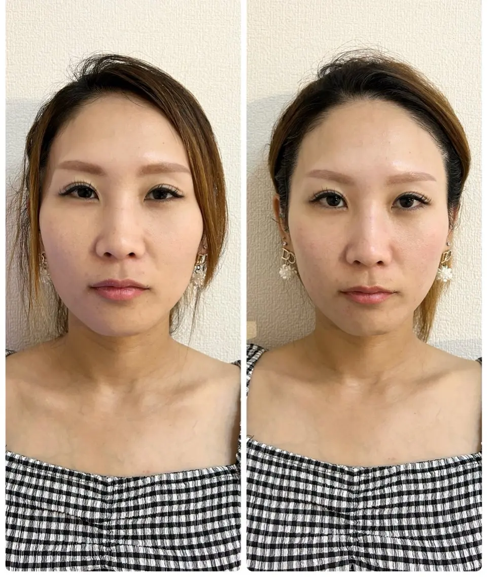エステ 肌管理 OGUMOのエステ・リラクイメージ