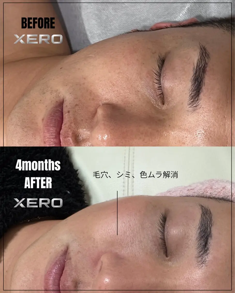 メンズ メンズ特化肌質改善 XEROのエステ・リラクイメージ