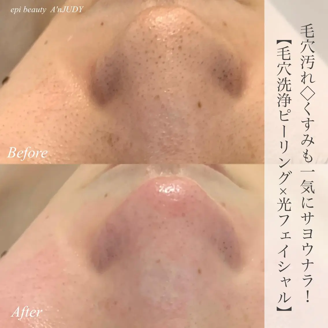 脱毛&ビューティー A'nJUDYの眉毛・アイブロウイメージ