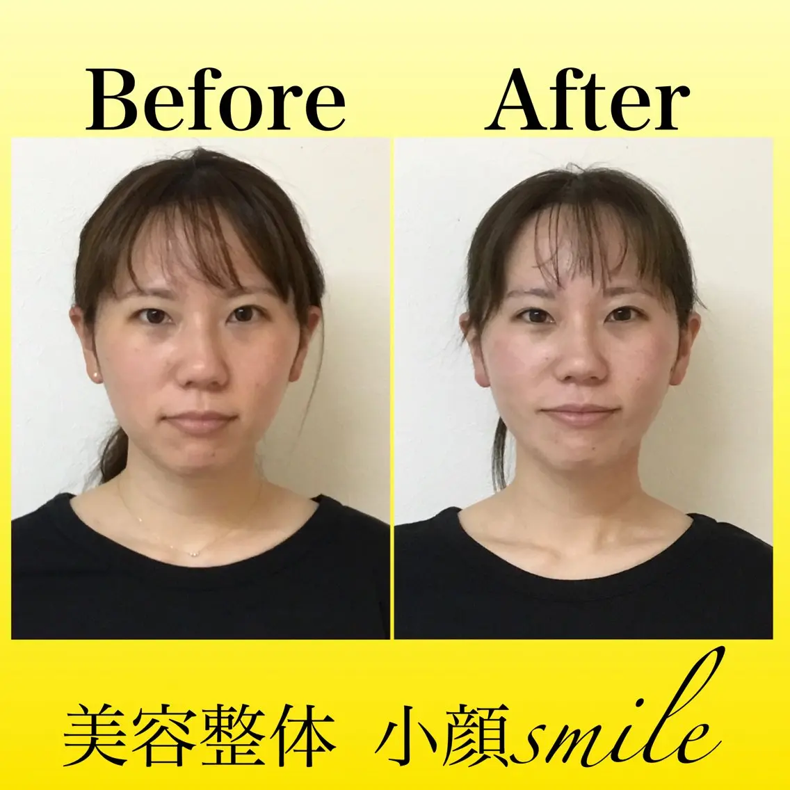 エステ リラク 【小顔矯正専門】 小顔smileのエステ・リラクイメージ