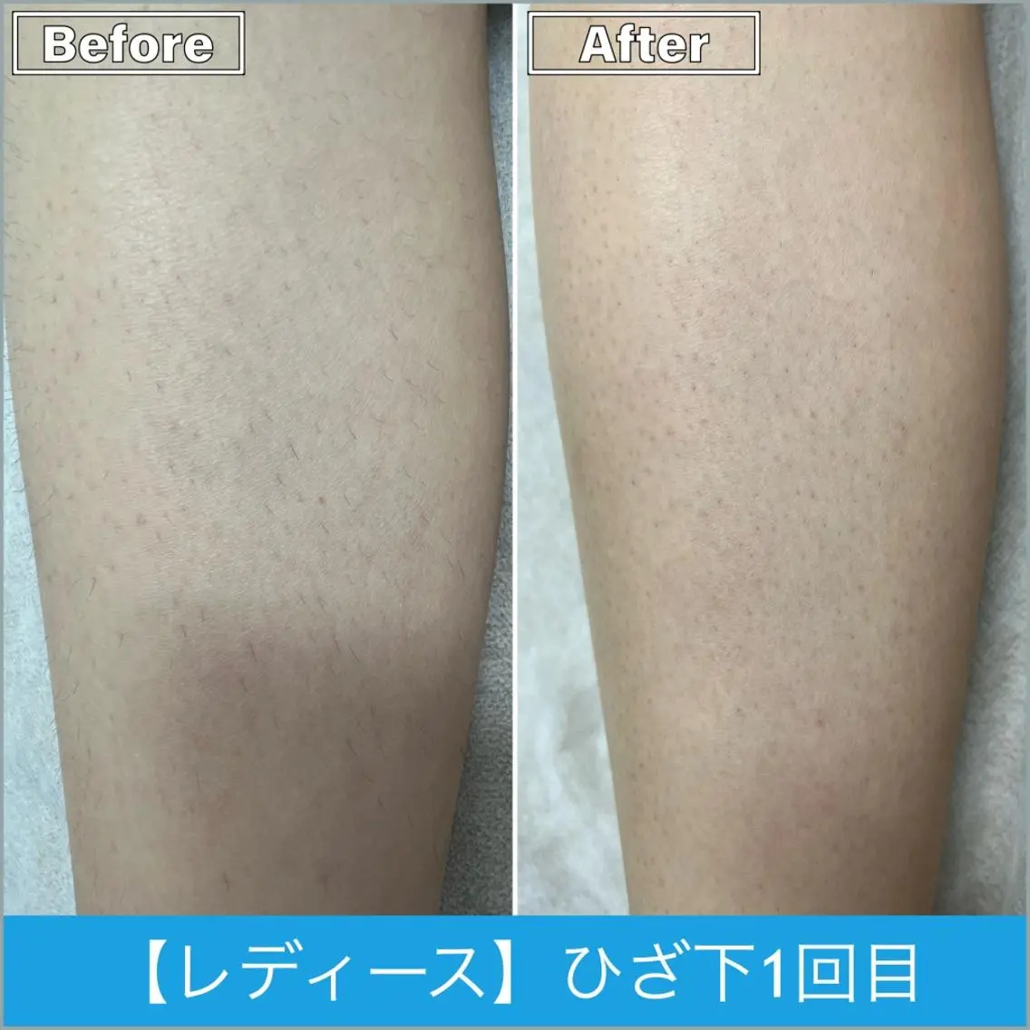 脱毛 プライベートサロン シャルムのその他イメージ