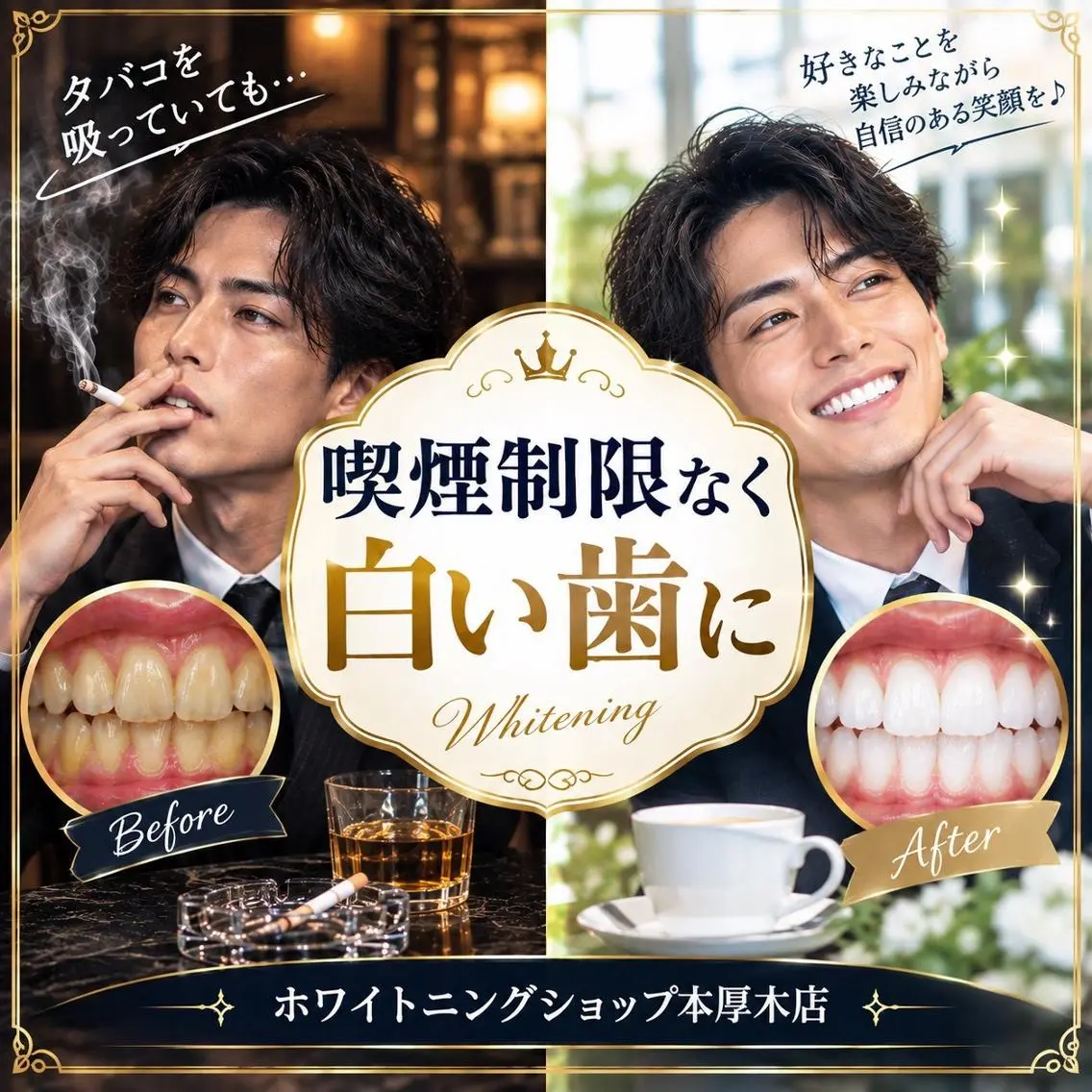 メンズ その他 ホワイトニング ショップ本厚木のその他イメージ