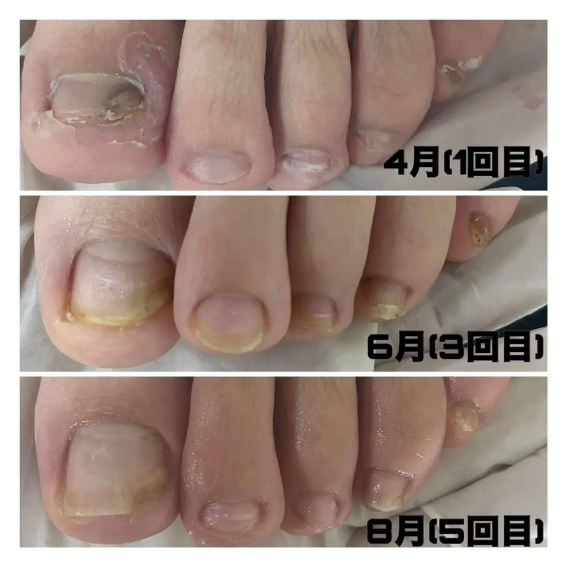 ネイル ジェルネイル 春ネイル nail salon petillantのネイルデザイン