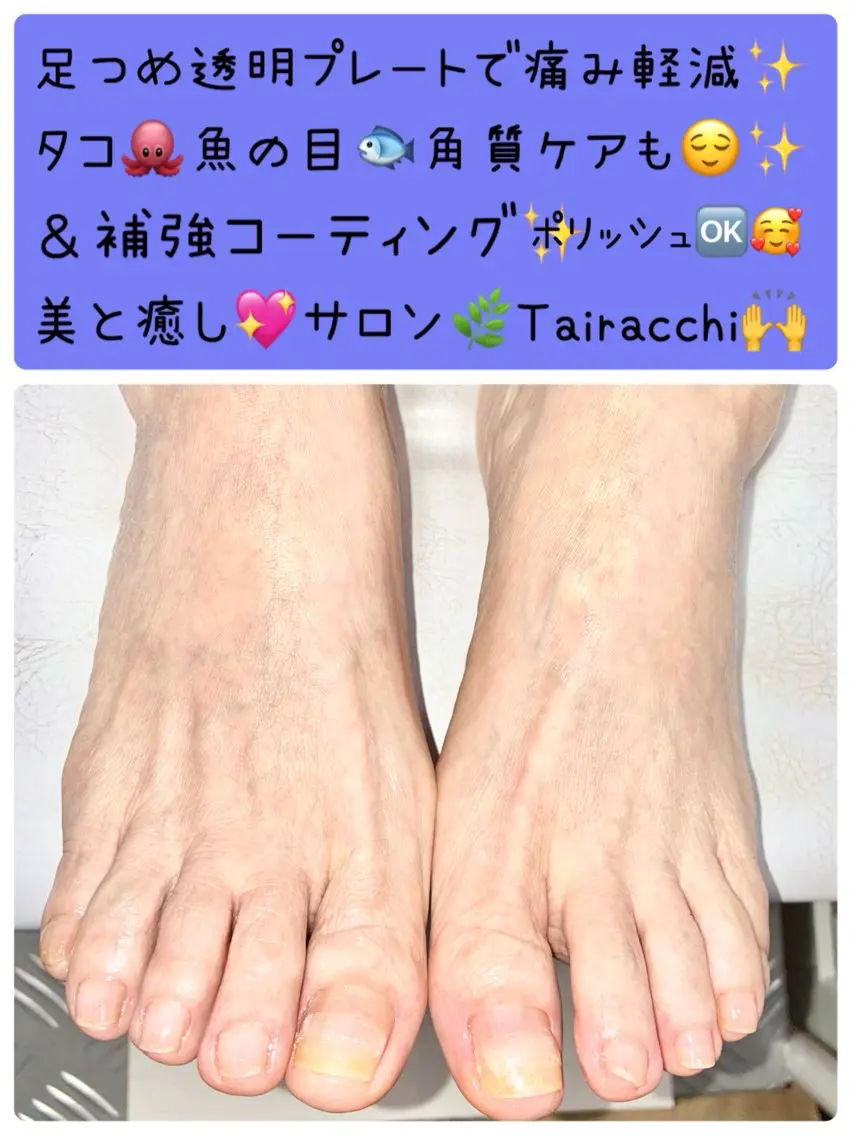ネイル フットネイル Tairacchi タイラッチのエステ・リラクイメージ