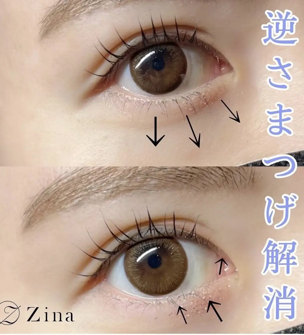 下まつげぱーまの写真