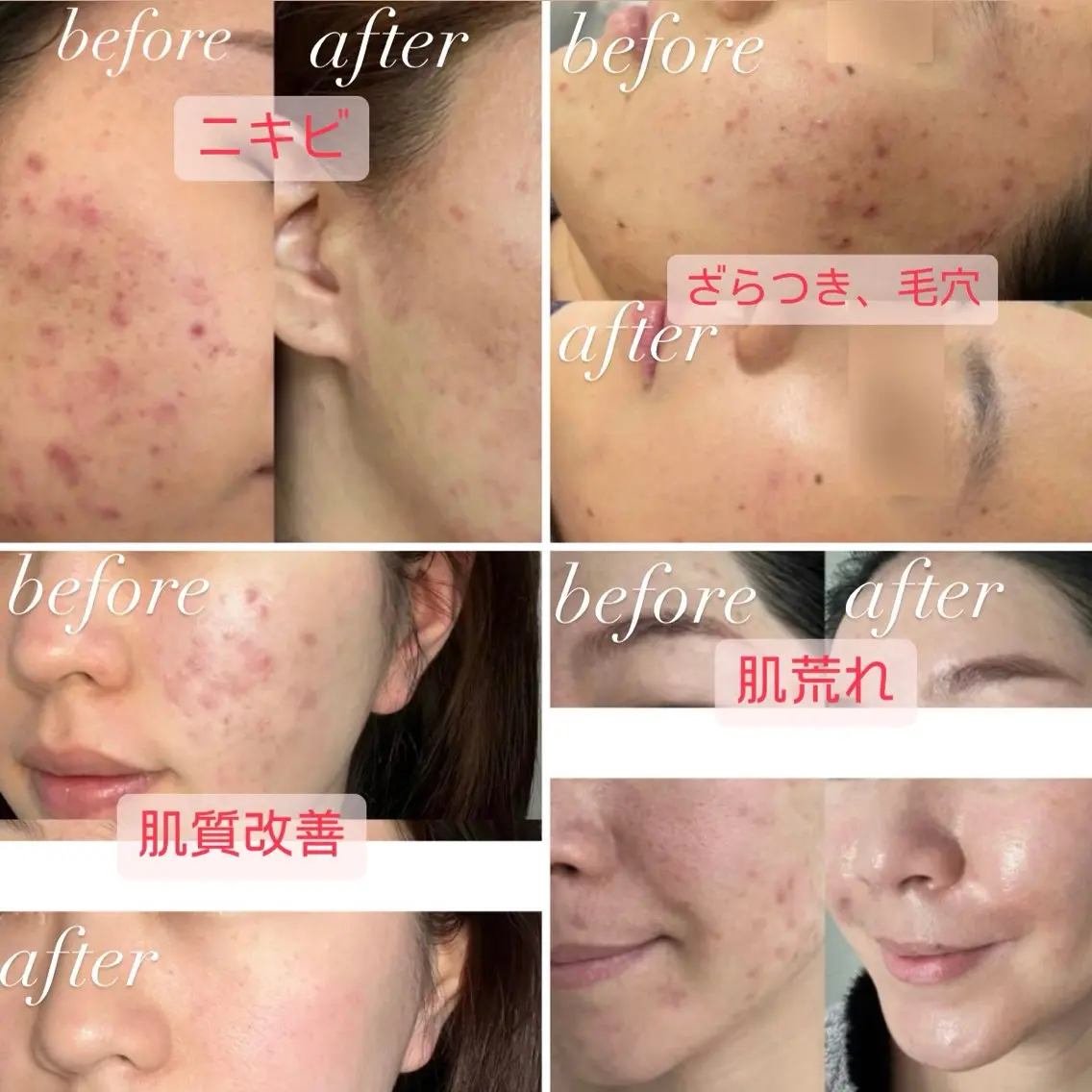 マツエク・マツパ エステ 愛維美水光美肌専門店 メンズレディースokのエステ・リラクイメージ