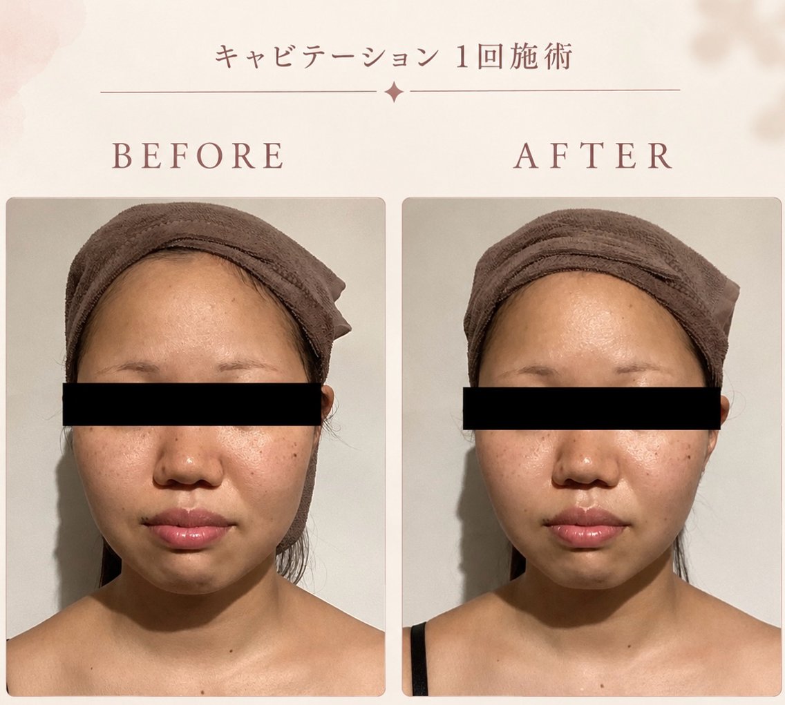 エステ 竹谷 日菜子のエステ・リラクイメージ