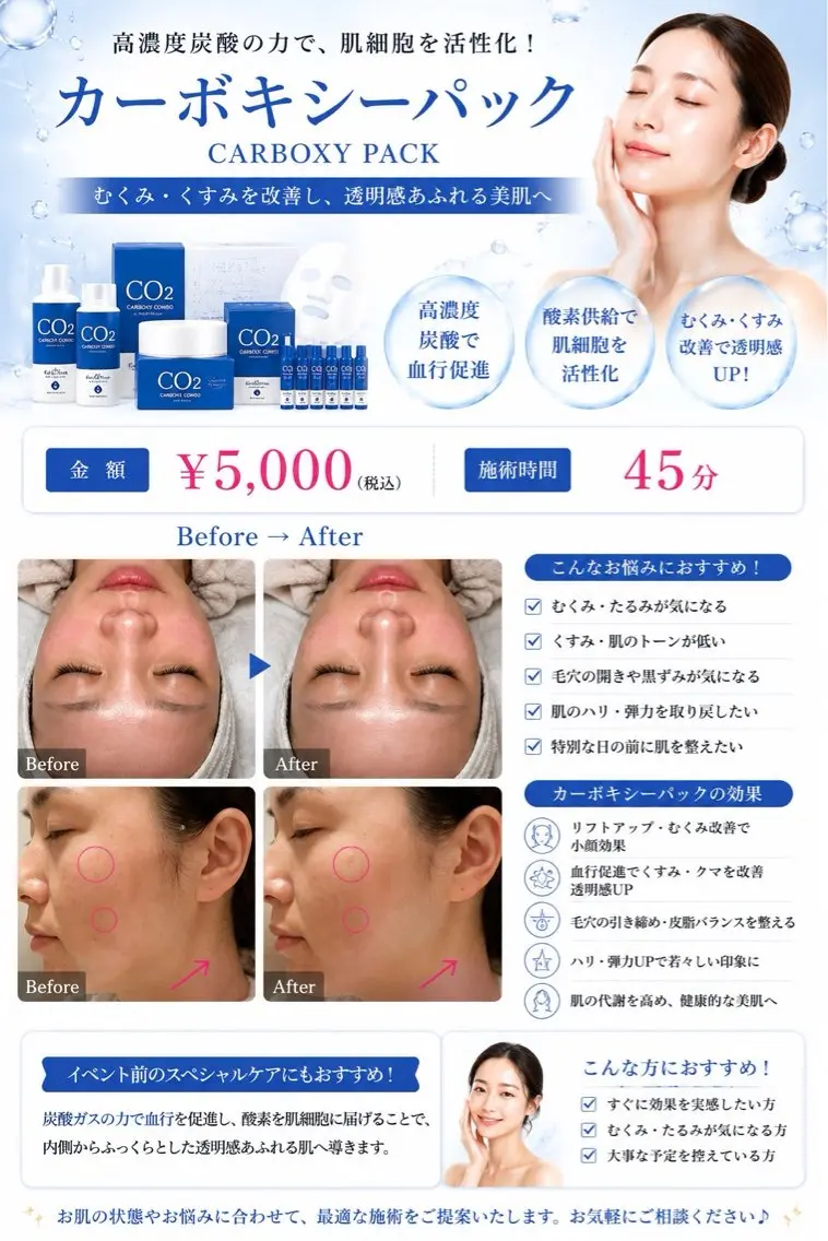 💙韓国式毛穴レス🇰🇷カーボキシー炭酸パックの写真