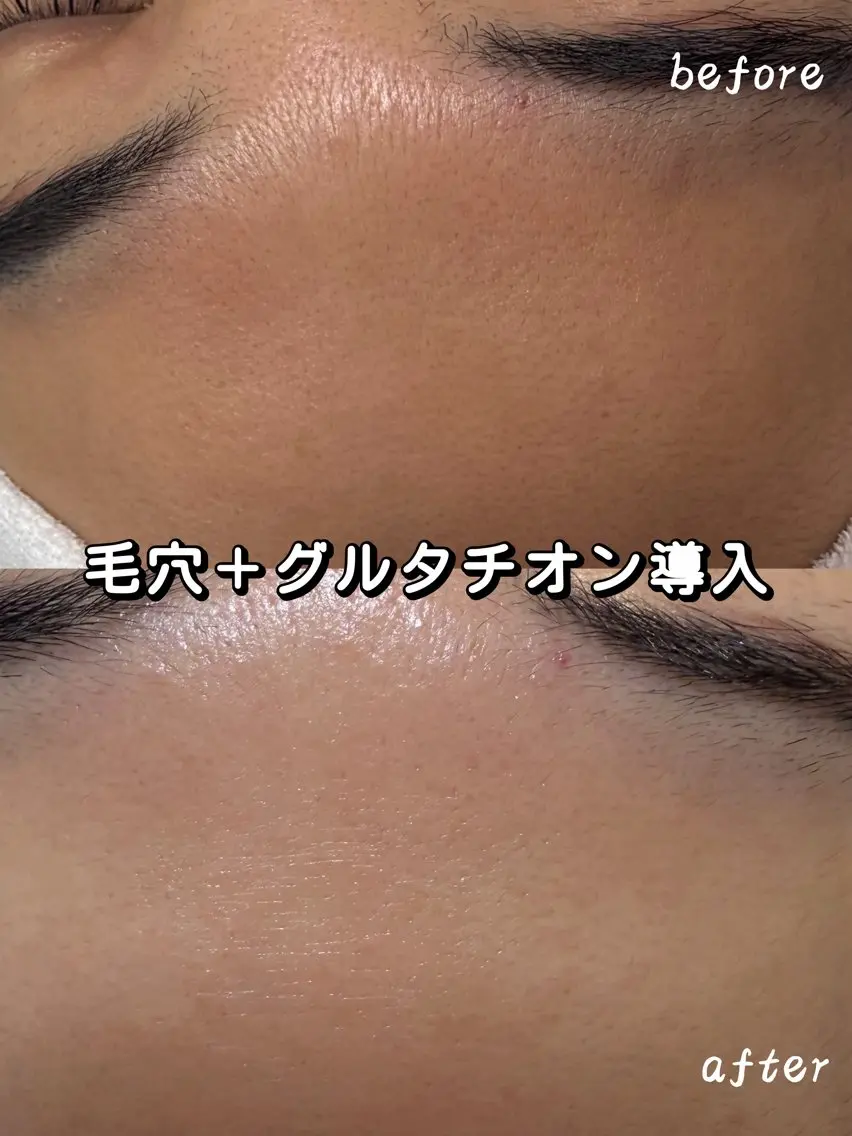 その他 Nature Souce毛穴専門店のその他イメージ