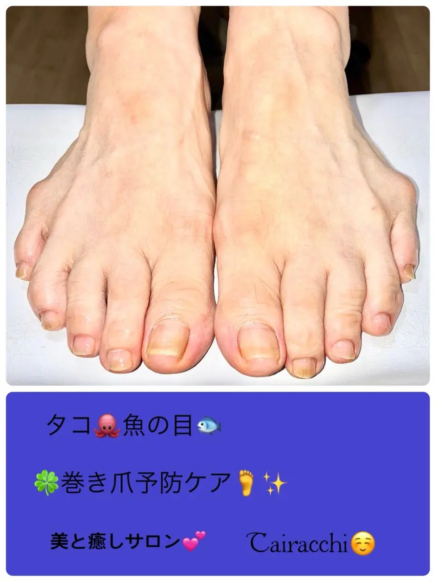 ネイル フットネイル Tairacchi ﾀｲﾗｯﾁのネイルデザイン