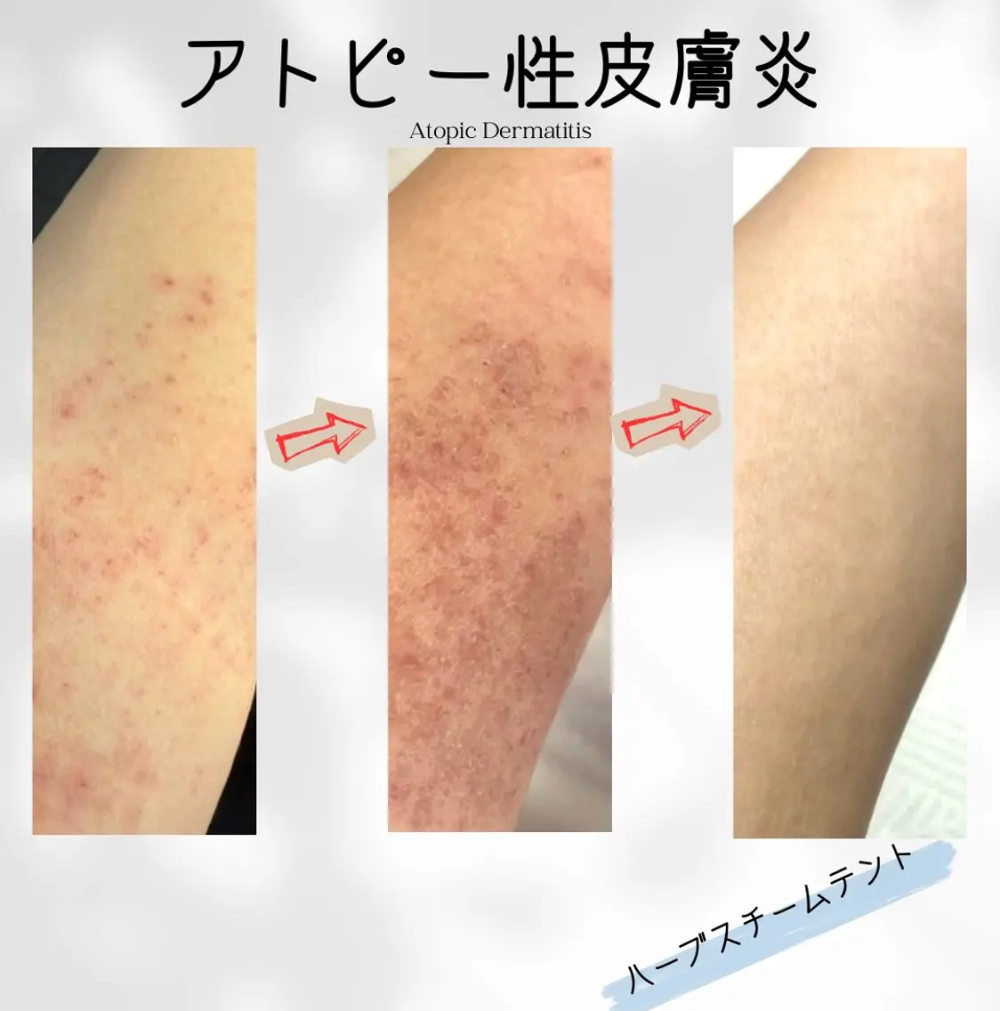 エステ リラク 体質改善✨美肌育サロ ン　香嬉琉🌿きよかのエステ・リラクイメージ