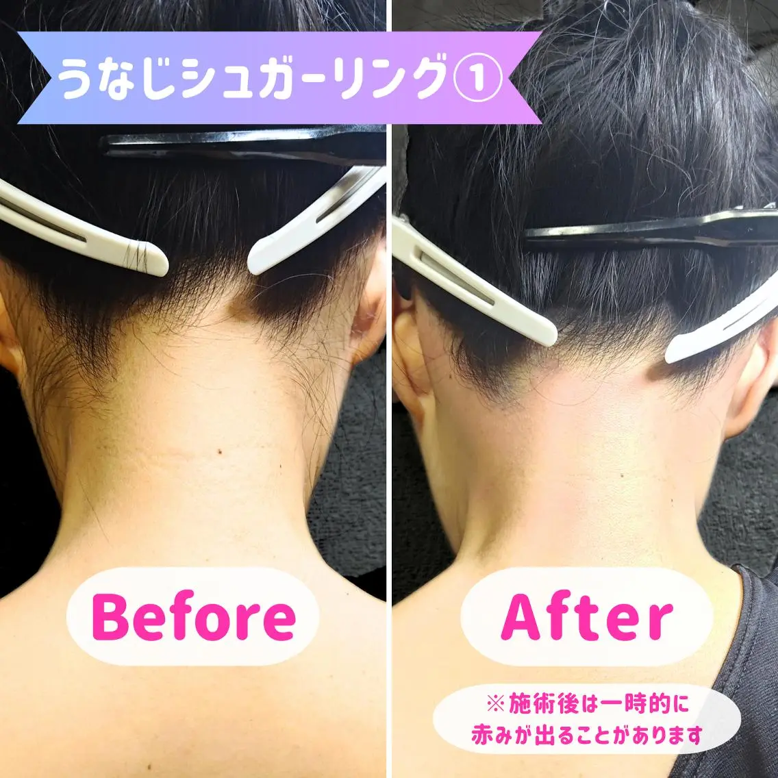 脱毛 SUCRE銀座 ヤマグチのエステ・リラクイメージ