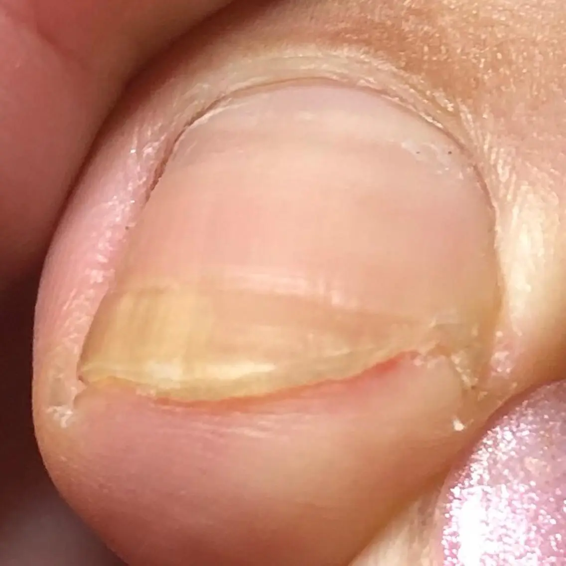 ネイル フットネイル .Nails Mio 赤羽西ネイルサロンのネイルデザイン