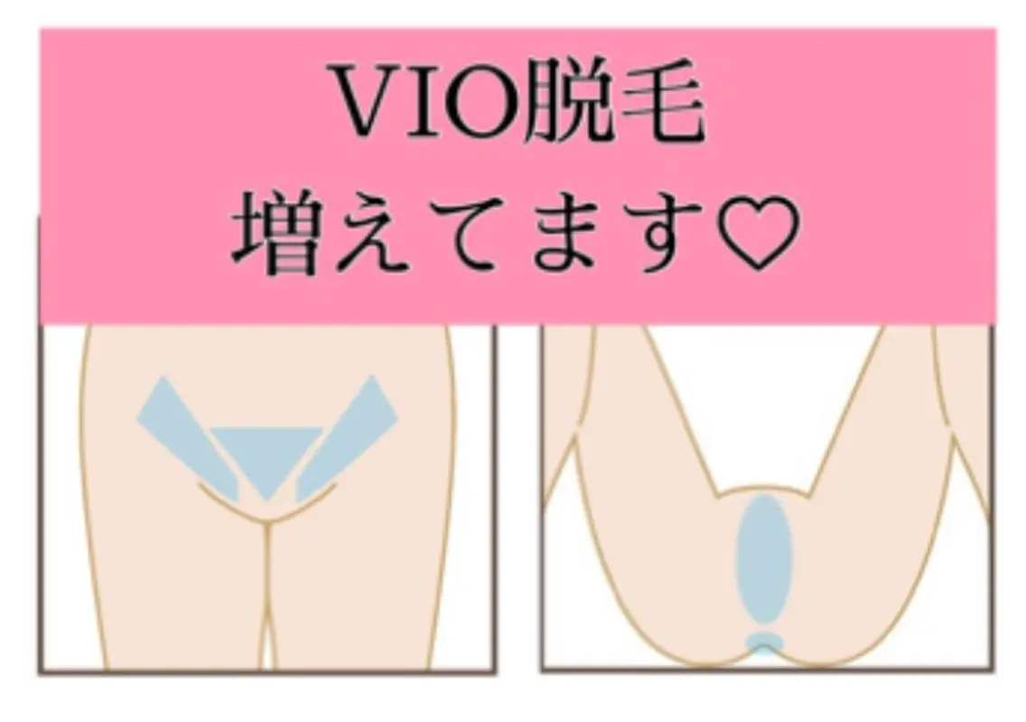 【🌹女性限定🌹vio3回セット脱毛👙】形は自由 ハイジニーナもok💕本気で毛を無くしたい💕痛み無し◎の写真
