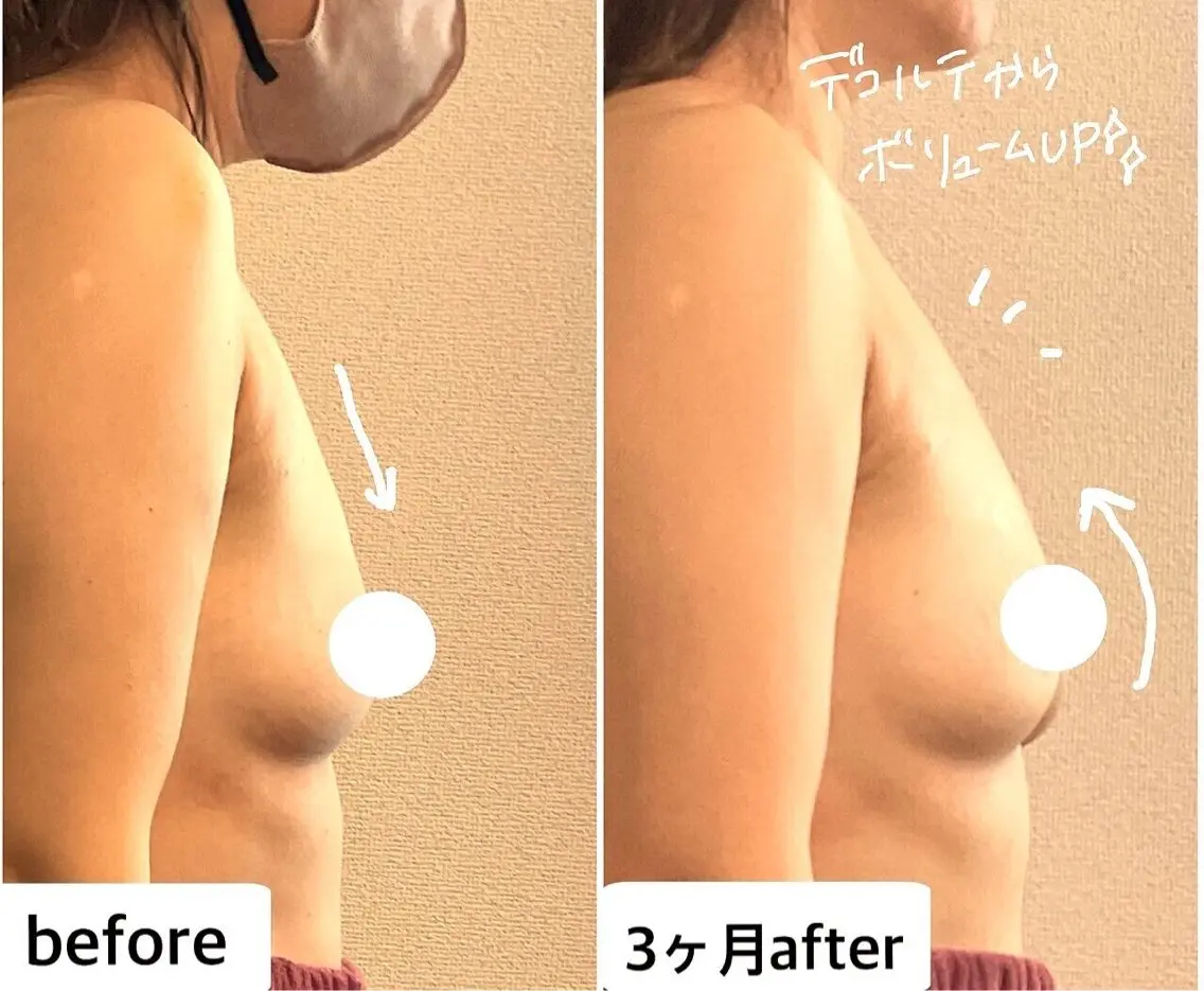 エステ 育乳痩身バストアップ サロン　つばききよらのエステ・リラクイメージ