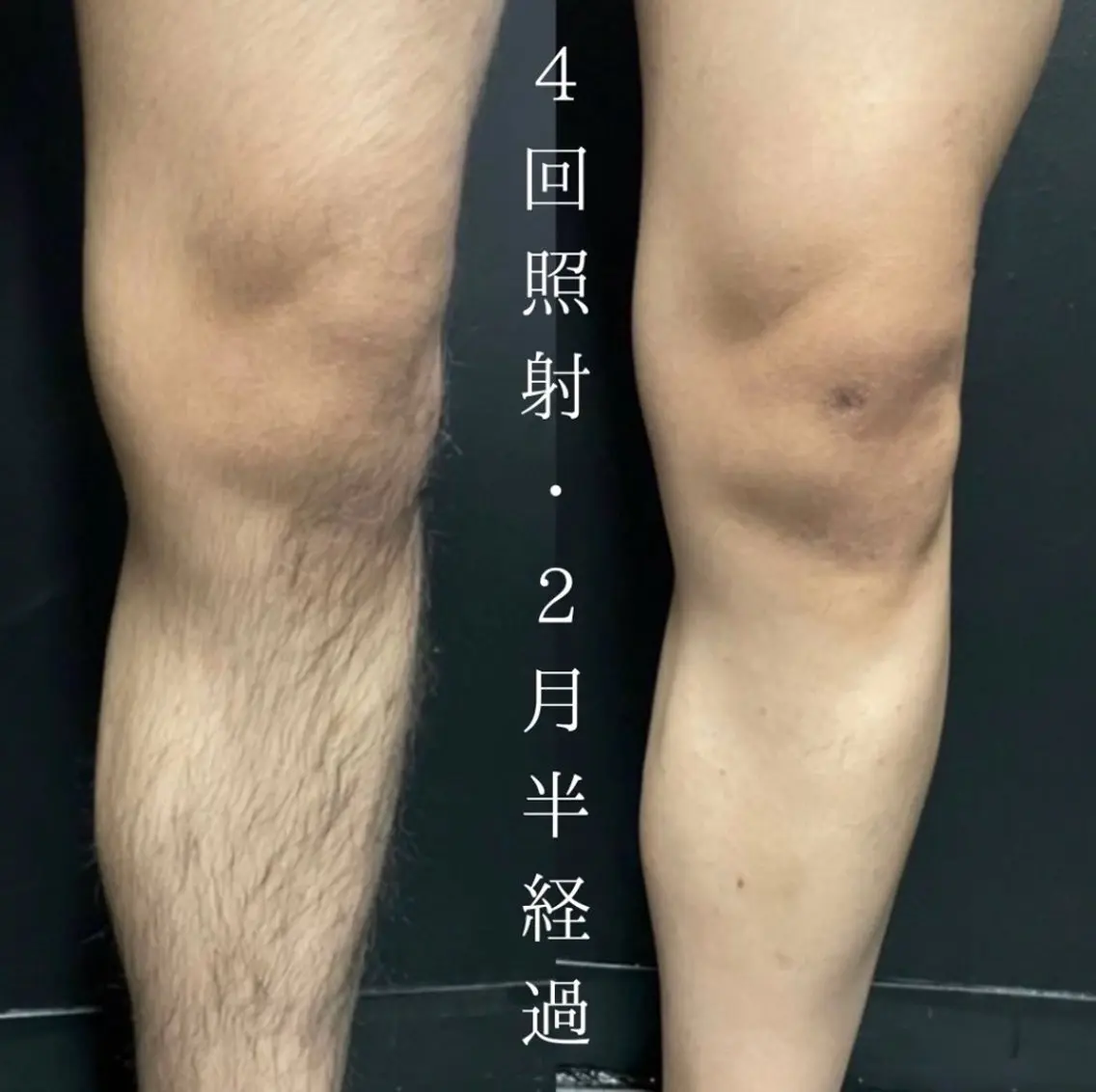 メンズ 脱毛 Neosalon ネオサロンのエステ・リラクイメージ