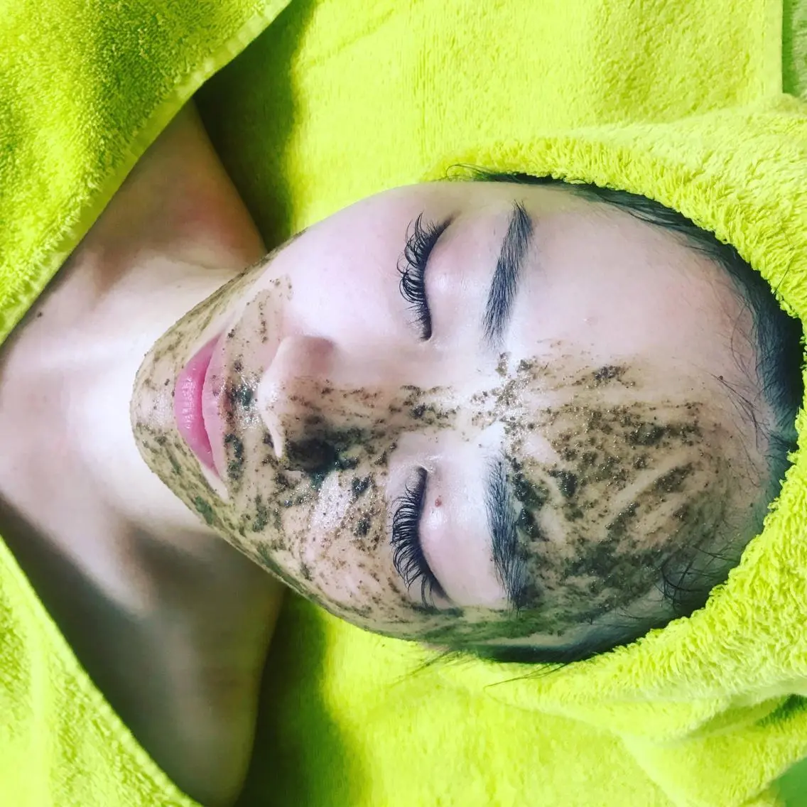 ハーブピーリング🌿2B美の最高峰になれるコース肌質改善の写真