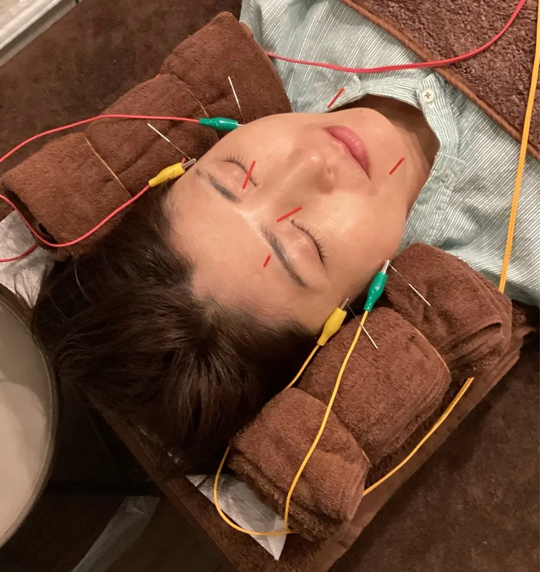 エステ リラク 小林整骨院本町 美容鍼roomのエステ・リラクイメージ