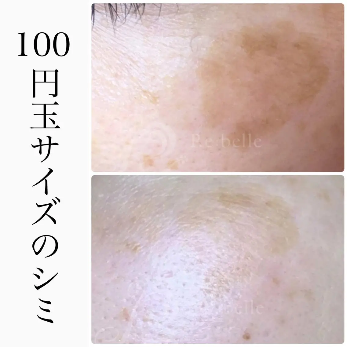 エステ ハーブピーリング専門 BIOEL横浜のエステ・リラクイメージ
