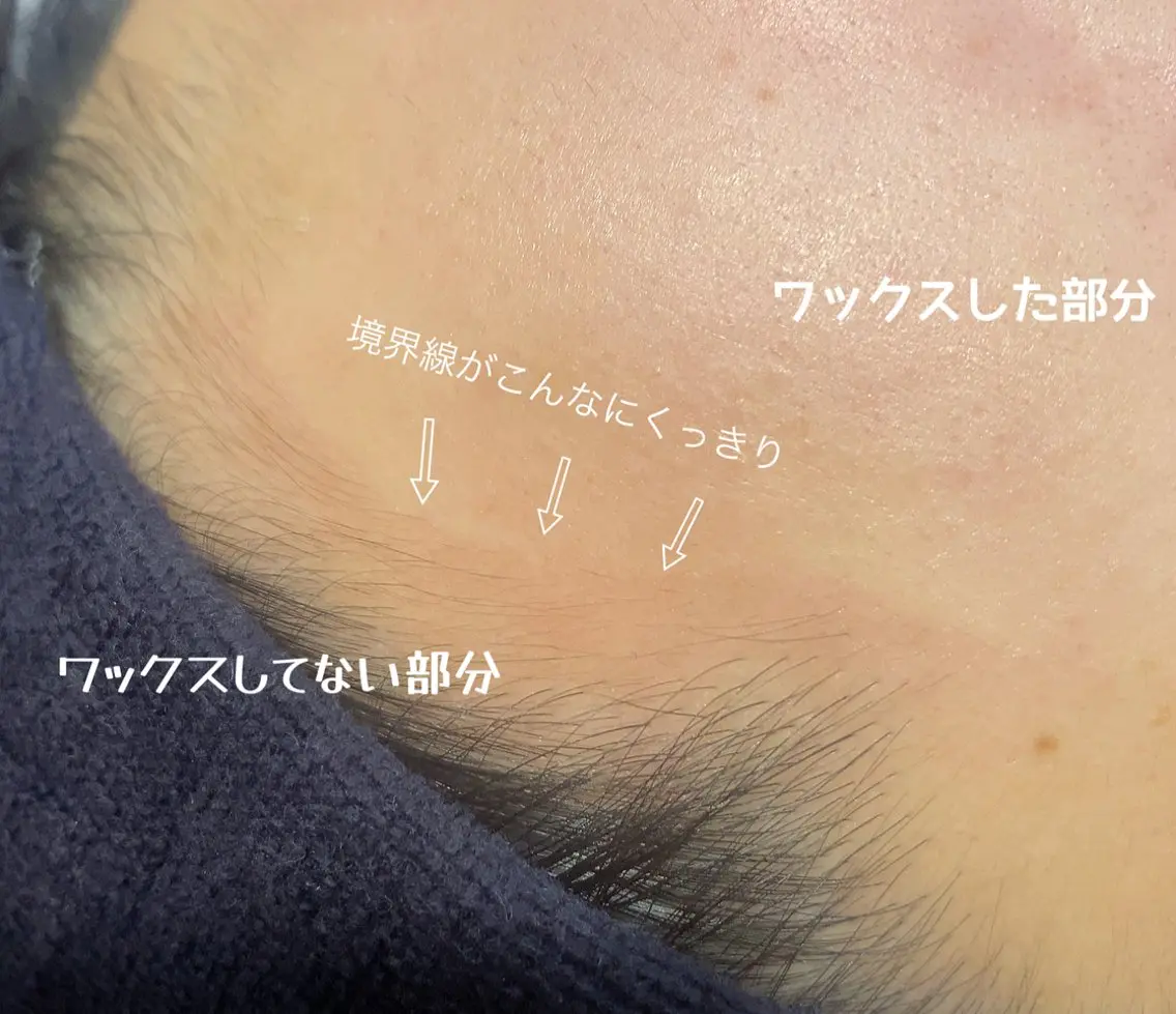 美肌への土台作り/スキンケアがぐんぐん浸透♪【一度限りお試し価格🤍】全顔/フェイシャルワックス＋鎮静保湿ケアの写真