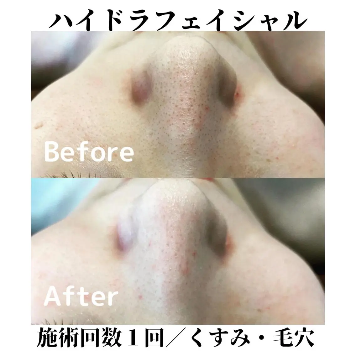 トータルビューティー サロンSalaのマツエク・マツパデザイン