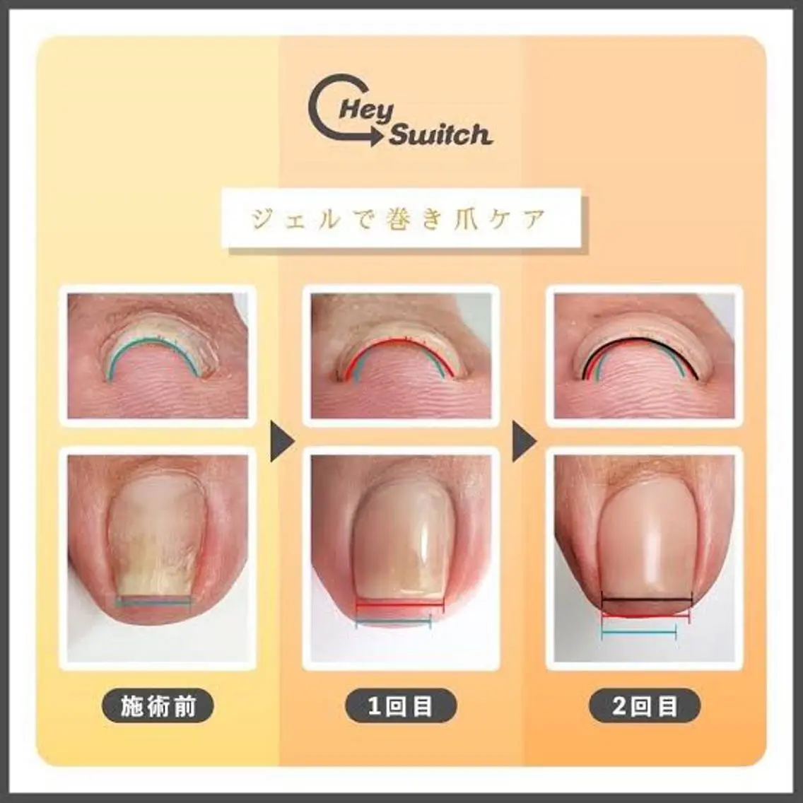 ショート ネイル Collection Nailsaronのネイルデザイン